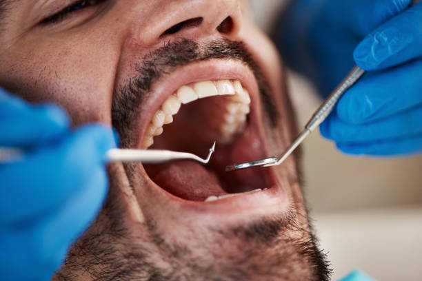 Emergency Dental Services in Harbor Hills, OH